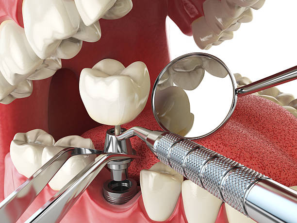 Best Emergency Root Canal Therapy in Rose Hill, NC